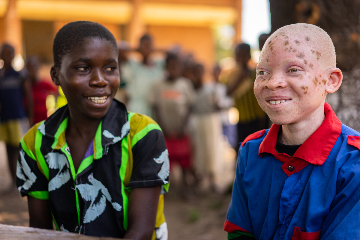 Chinsisi Jafali (rechts) mit einem seiner dunkelhäutigen Freunde. Der junge Albino lebt in Kunaunje in Malawi. (Foto: WFP/Badre Bahaji)