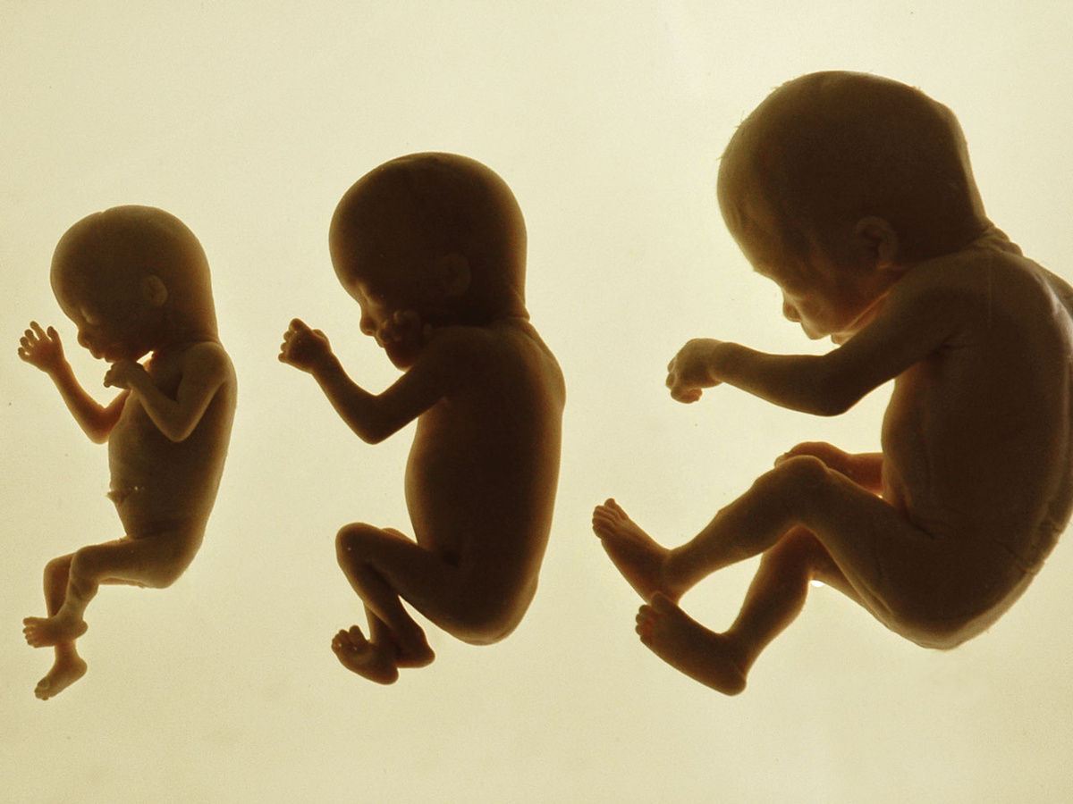 Haben Ungeborene das Recht zu leben? Bislang sind Abtreibungen in Deutschland nur unter bestimmten Voraussetzungen straffrei. (Foto: gem)