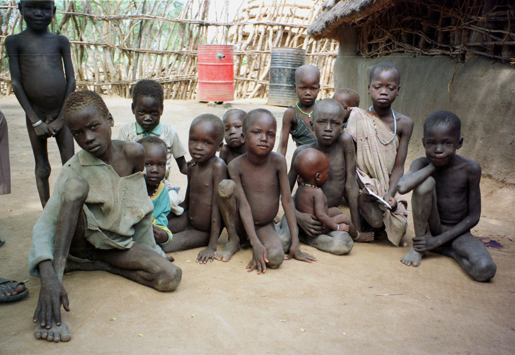 Hungernde Kinder im Südsudan. (Foto: KNA)